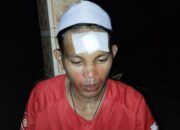 Tragis! Warga Pagerungan Besar Dianiaya, Lapor Polisi Tanpa Bukti