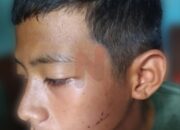 Siswa SMP 14 Bintan Diduga Jadi Korban Penganiyaan Dua Guru