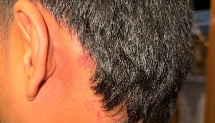 Pelaku Penganiayaan Brutal Anak di Bawah Umur Dilaporkan ke Polisi