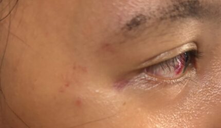 Berawal dari Stalking Medsos, Perempuan Diduga Dianiaya Istri Mantan Kekasih hingga Dibawa Keliling