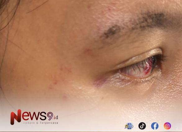 FOTO: Korban dugaan penganiayaan yang dilakukan oleh seorang laki-laki. @by_News9.id