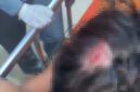 FOTO: AR, korban dugaan pengeroyokan saat mendapat perawatan medis. @by_News9.id 