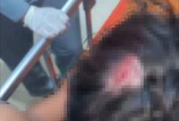 FOTO: AR, korban dugaan pengeroyokan saat mendapat perawatan medis. @by_News9.id 