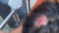 FOTO: AR, korban dugaan pengeroyokan saat mendapat perawatan medis. @by_News9.id 