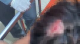 FOTO: AR, korban dugaan pengeroyokan saat mendapat perawatan medis. @by_News9.id 