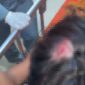 FOTO: AR, korban dugaan pengeroyokan saat mendapat perawatan medis. @by_News9.id 