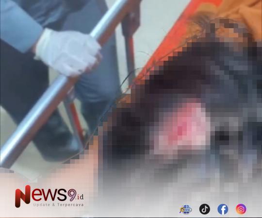 FOTO: AR, korban dugaan pengeroyokan saat mendapat perawatan medis. @by_News9.id 